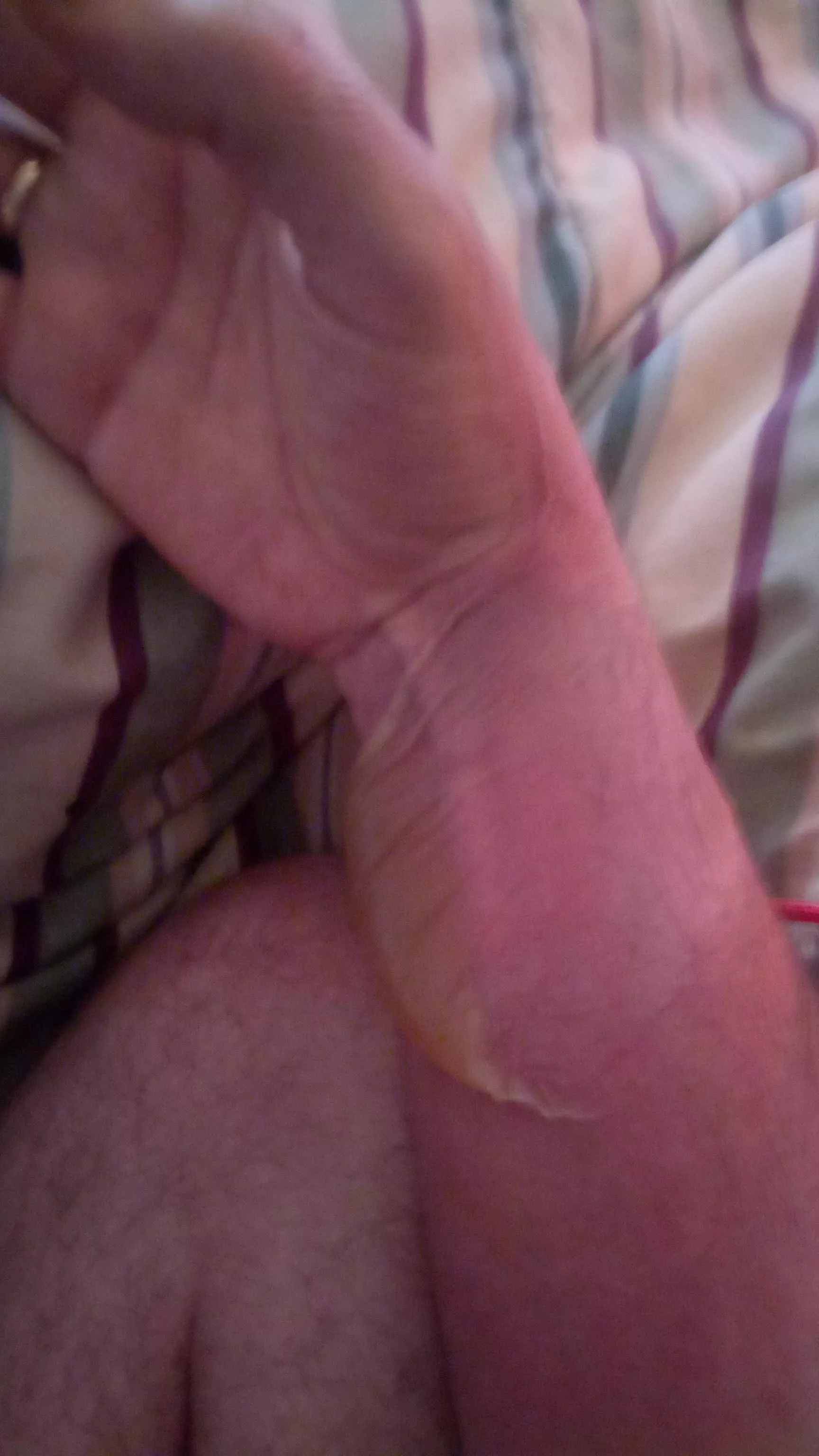 Forbidden pop, radiator burn (OC)