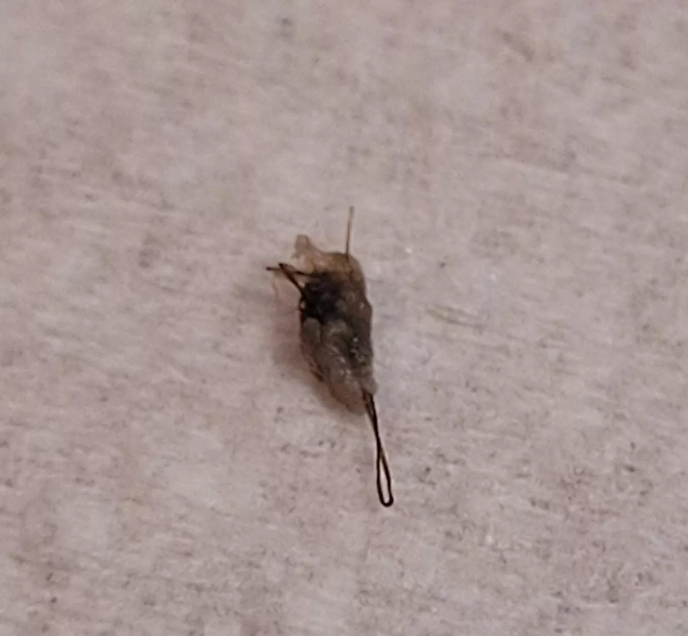 This is what came out of a bump on my thigh. Wish I had recorded; the pop was audible.