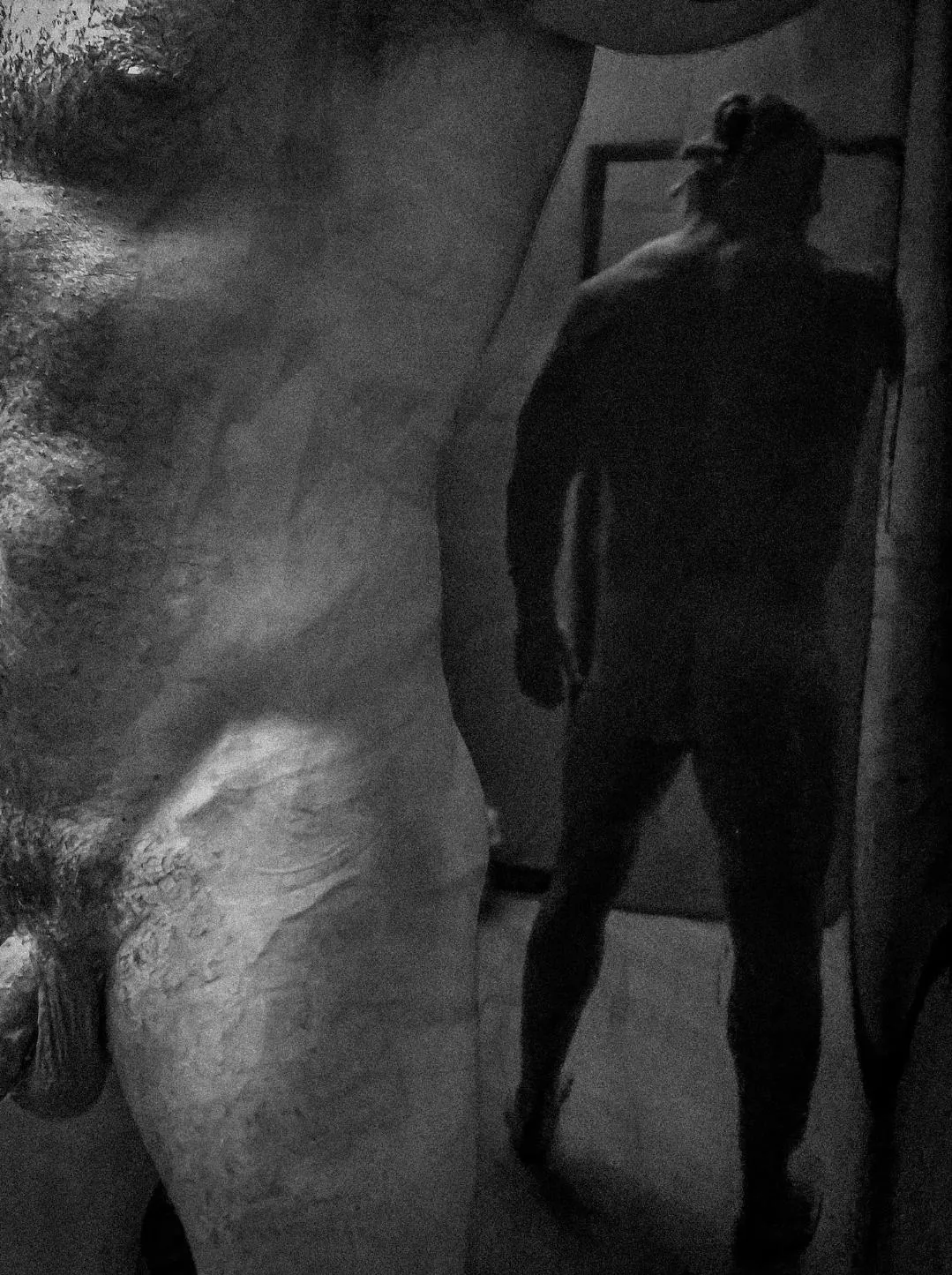 Hip veins with the abdominal V