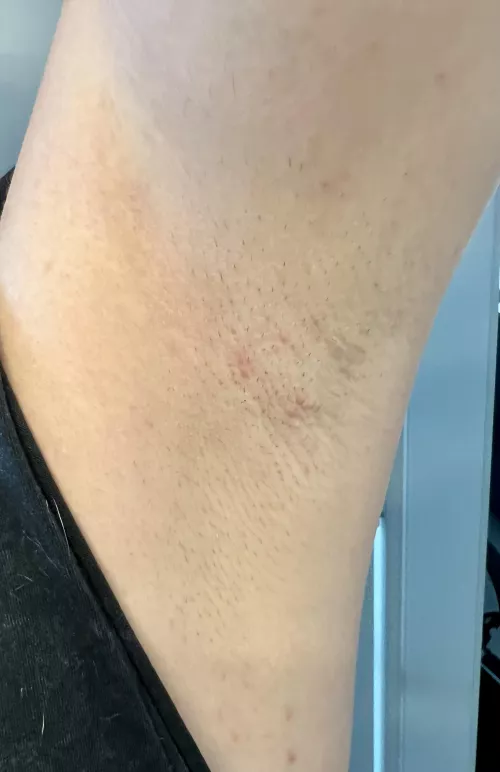 I’m afraid I’m a little hairy 😛