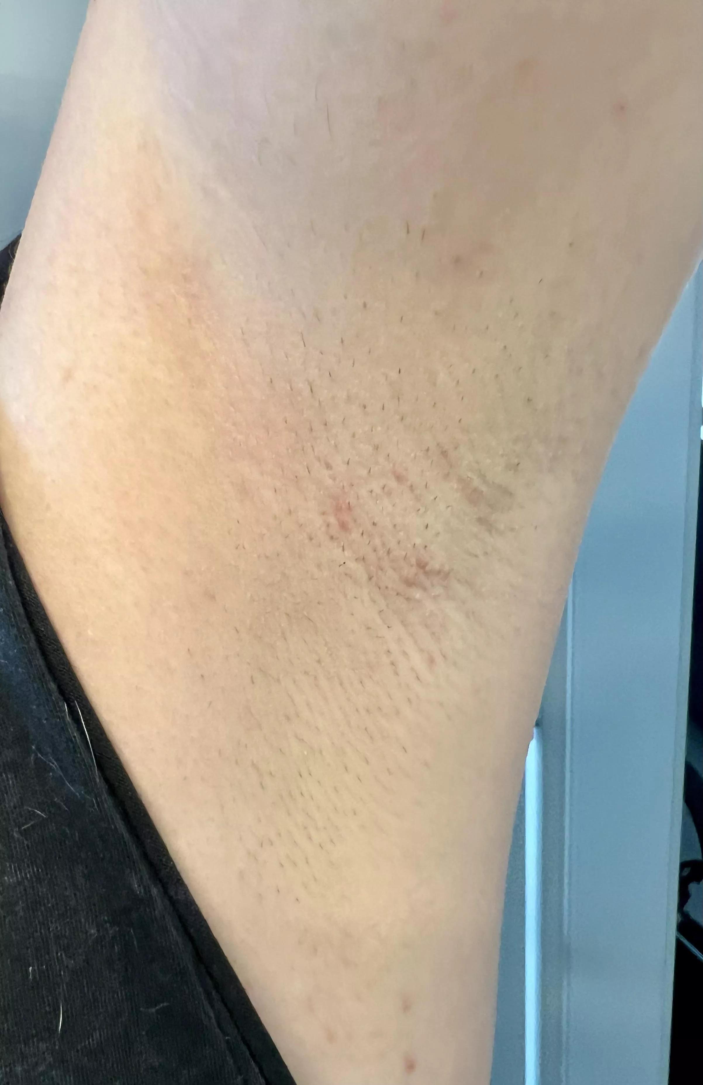 I’m afraid I’m a little hairy 😛