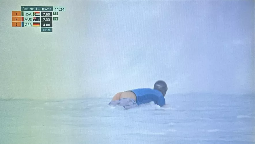 Do you get more points for this or at least a medal ?? 🥇 