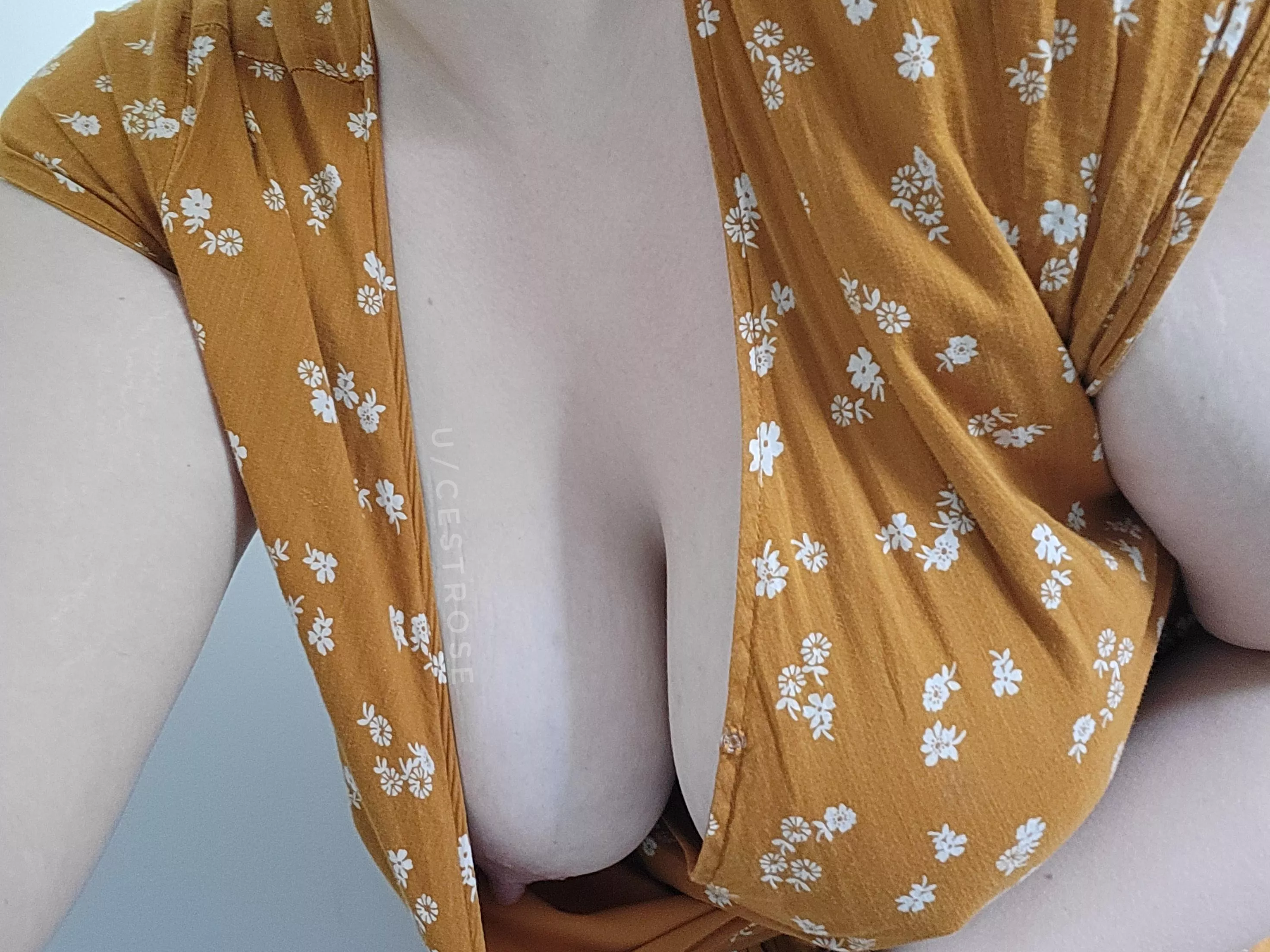 Please excuse my fashion mishap