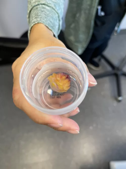 Named it Shiva - because it literally looks like an eyeball. 