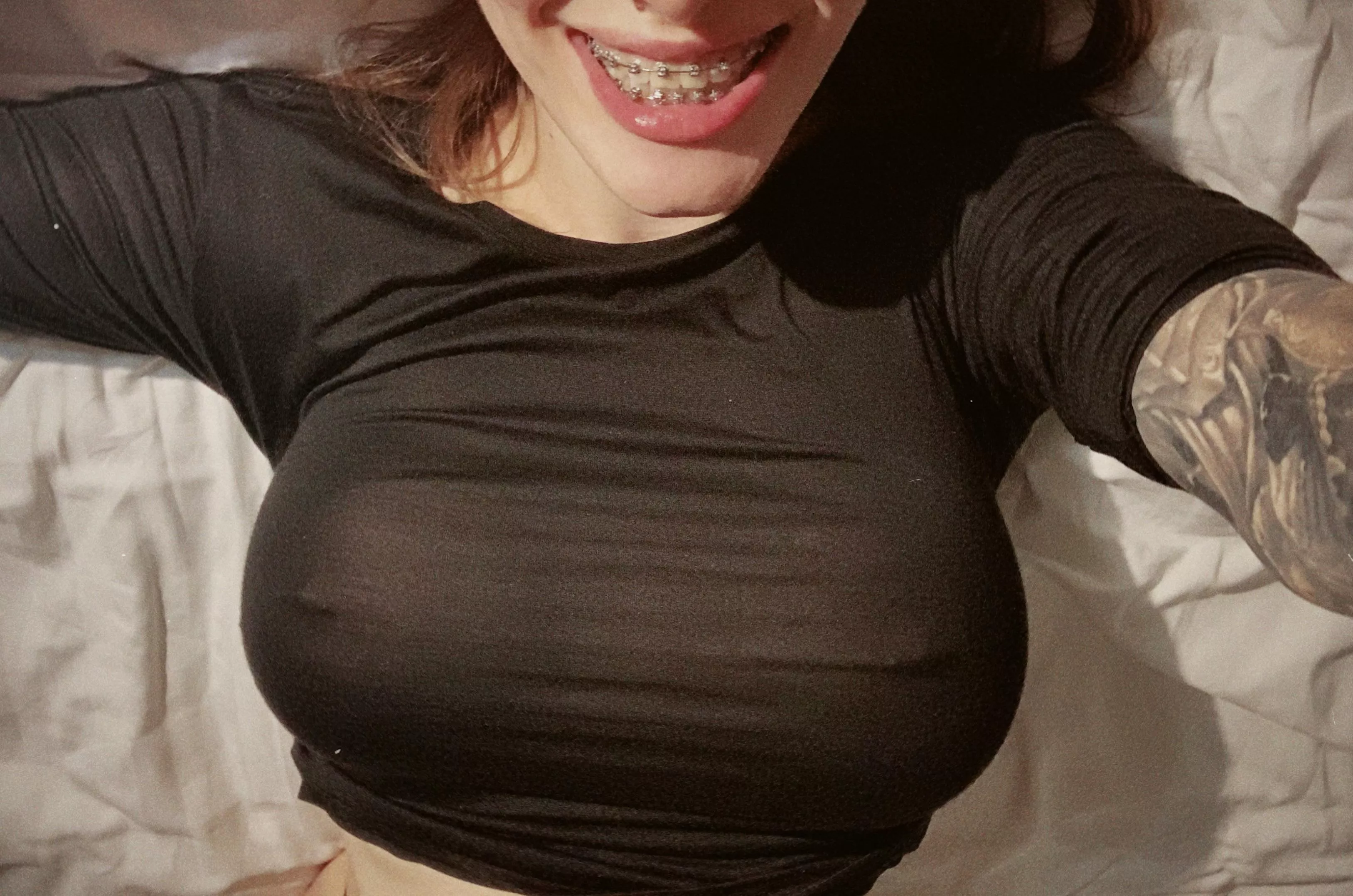 Braces and tits 