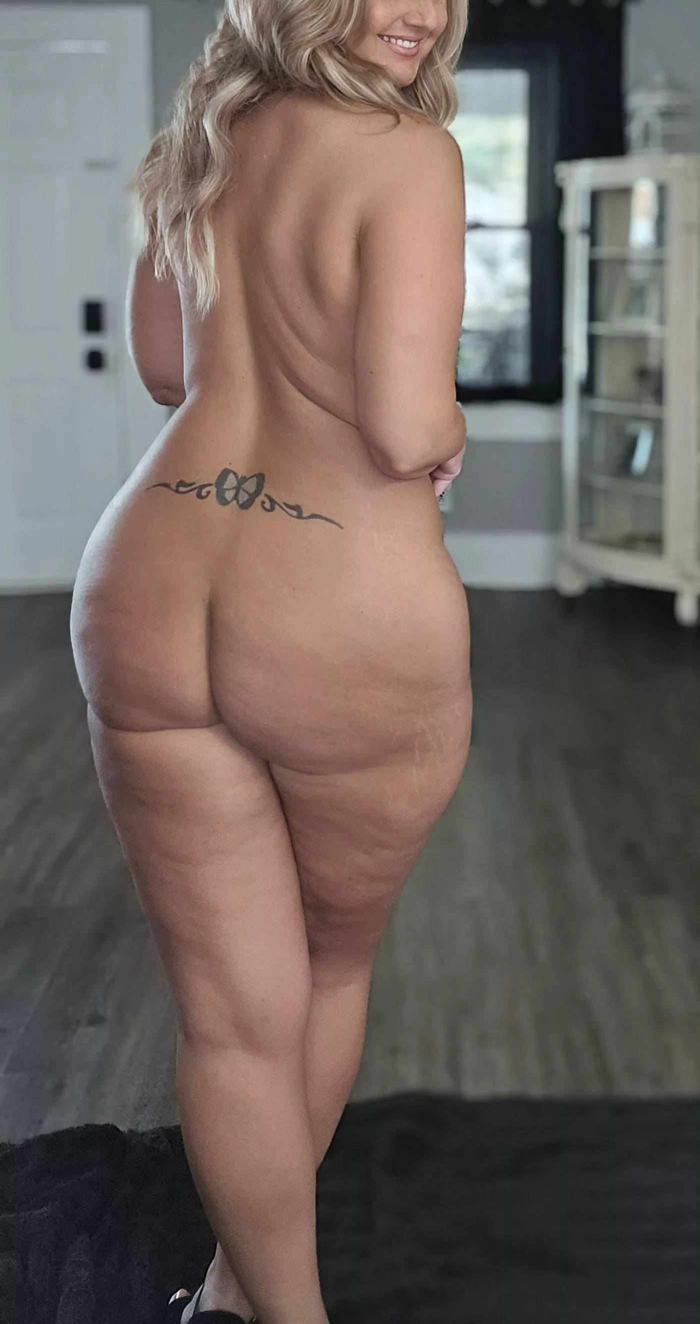 Cellulite and tiger stripes 