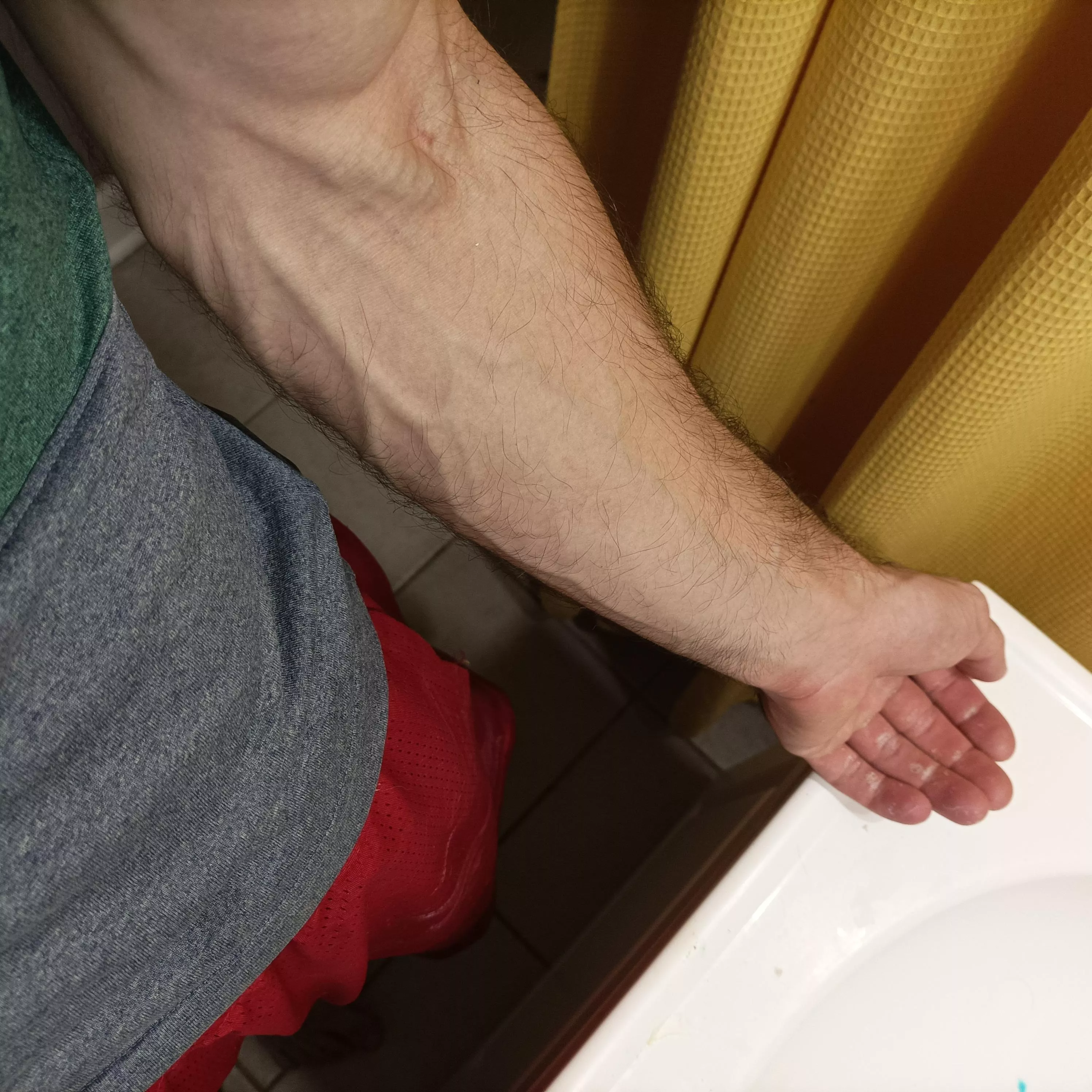 My arms after climbing 