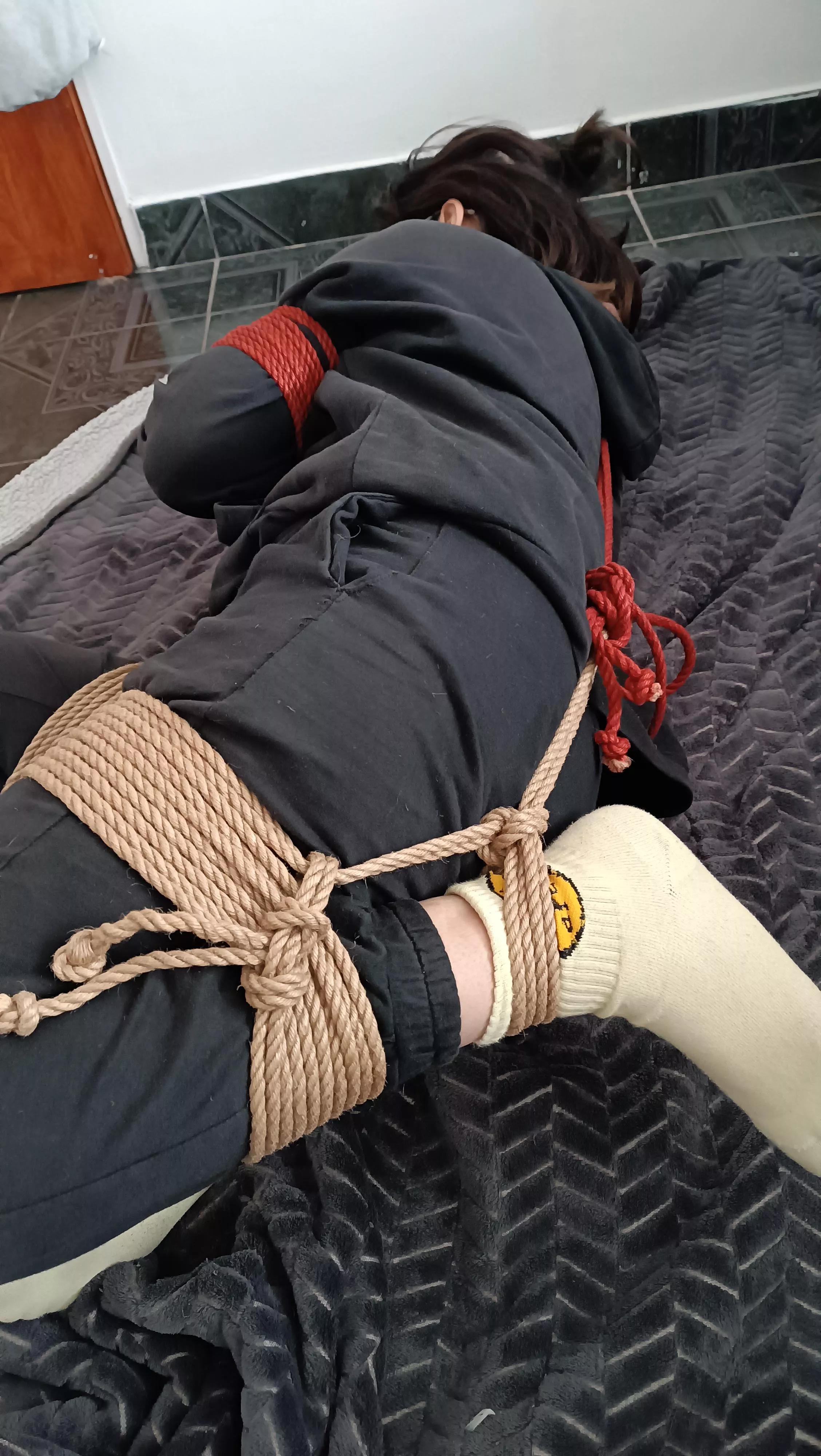 Too early to immobilize?