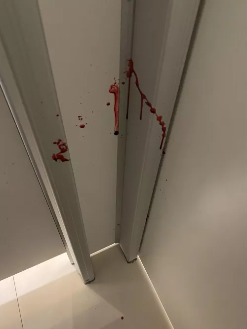 Aftermath of boil that popped during work