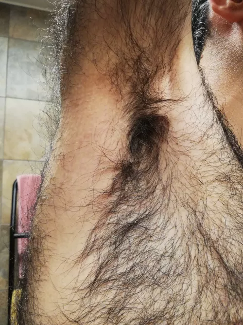 How hairy is this? 