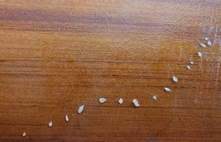 The hard gunk inside my brother's face bumps, all popped in one sitting. What do you call these things again?