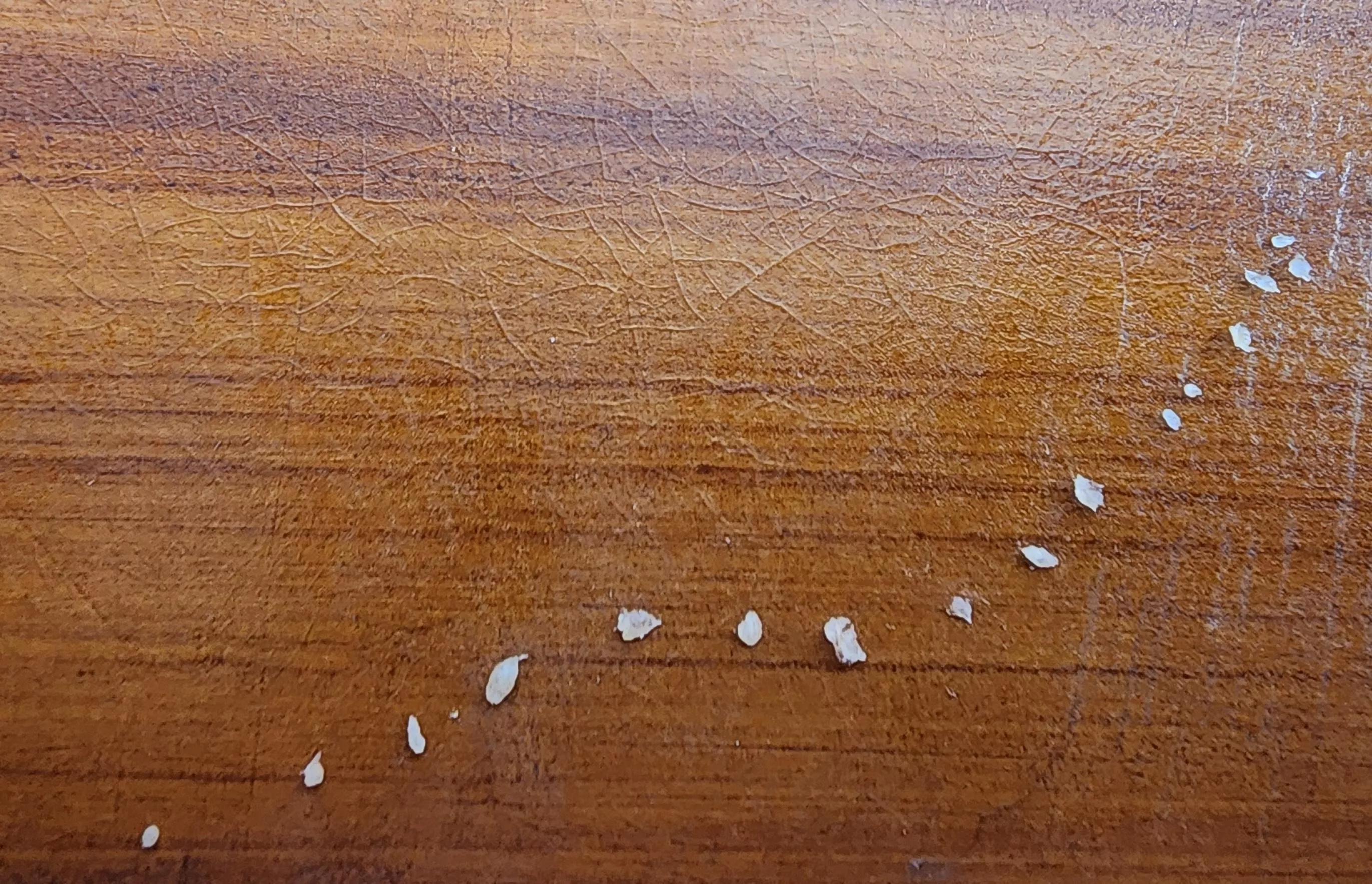 The hard gunk inside my brother's face bumps, all popped in one sitting. What do you call these things again?