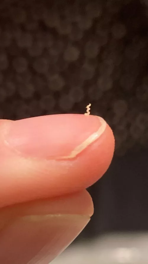 A blackhead of mine turned into a perfect little spiral 