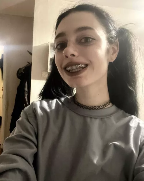 braces and pigtails again!! 