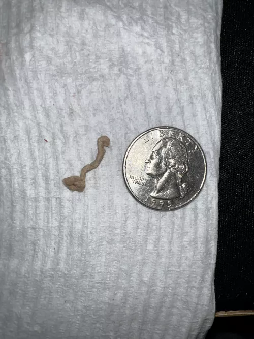 I’ve had a small cyst on my face for 5+ years and today I finally popped it. Quarter for scale 