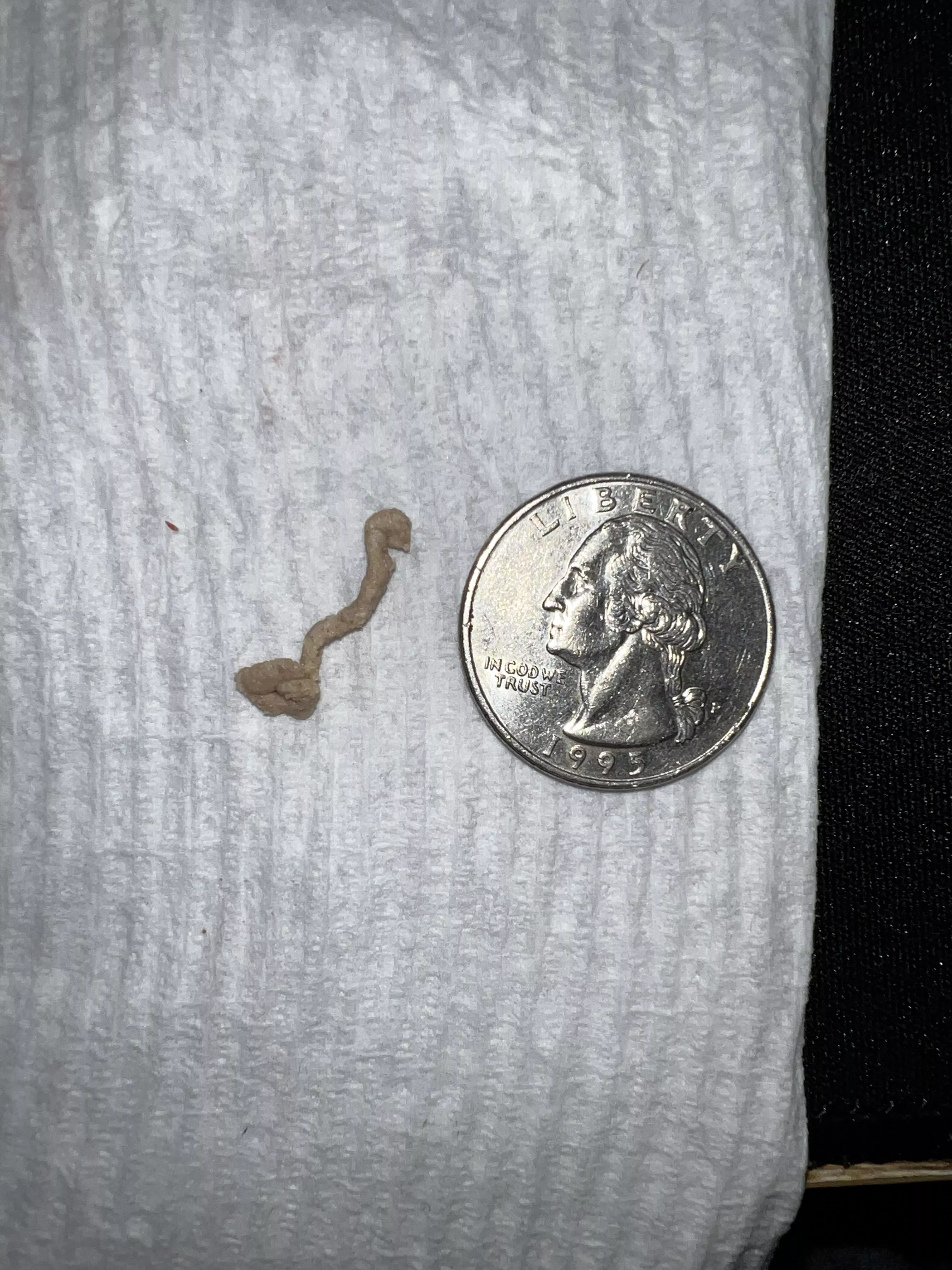 I’ve had a small cyst on my face for 5+ years and today I finally popped it. Quarter for scale 