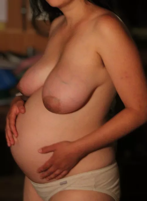 Pregnancy candid. Red and swollen.