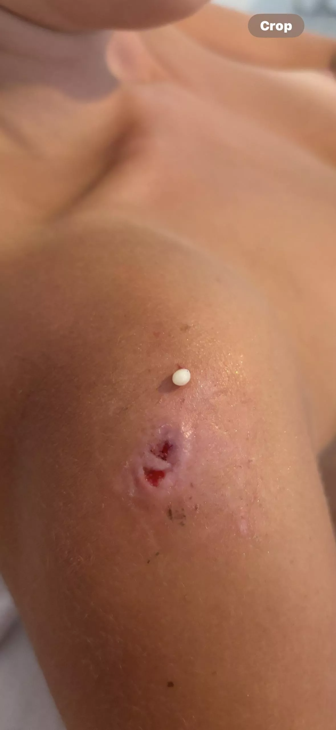 Videos- are there links to decent squeezing videos