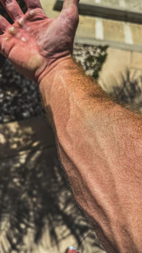 Calluses on hands? Yes or no 