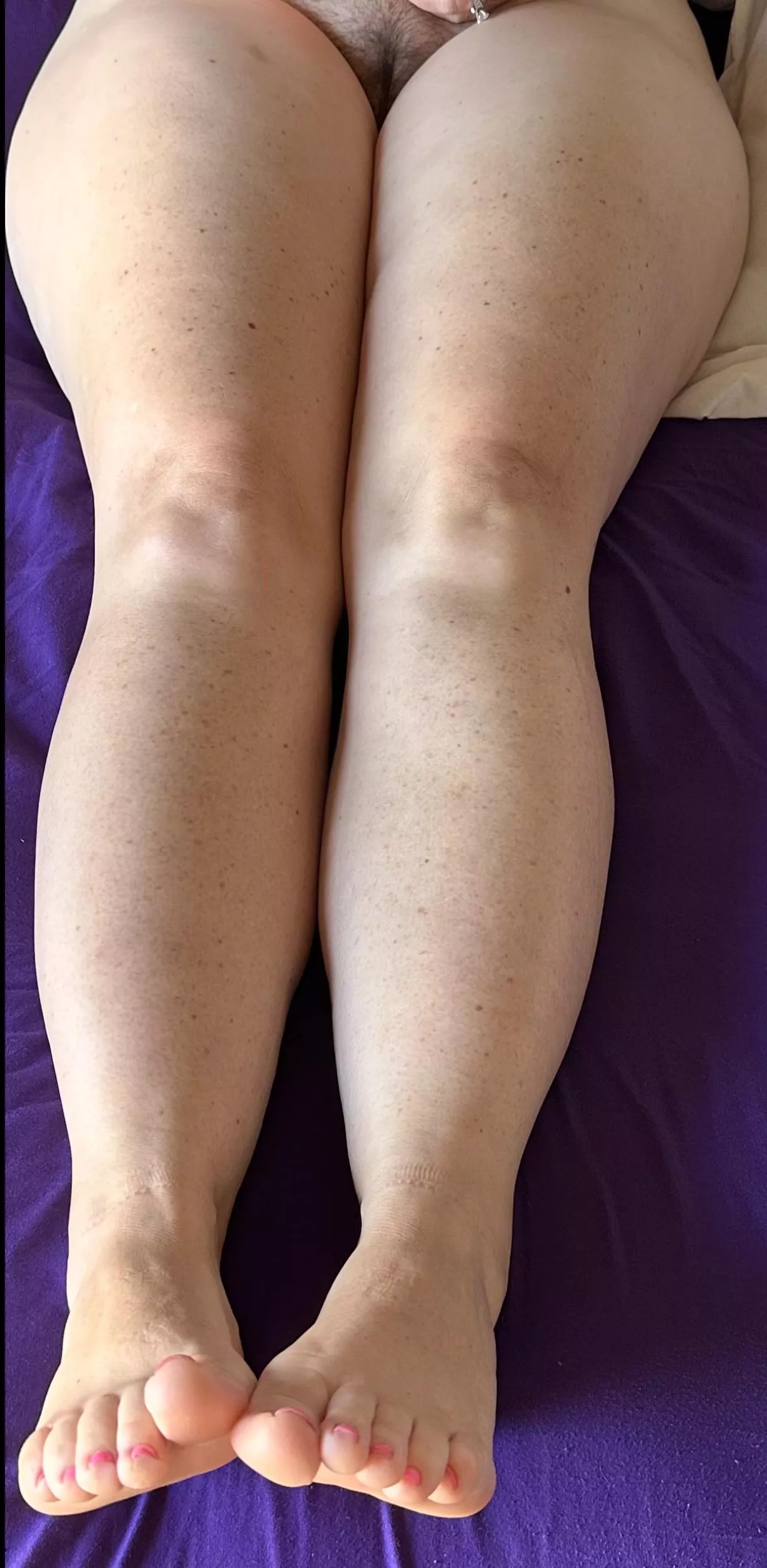 These thighs need more sun.  💍 