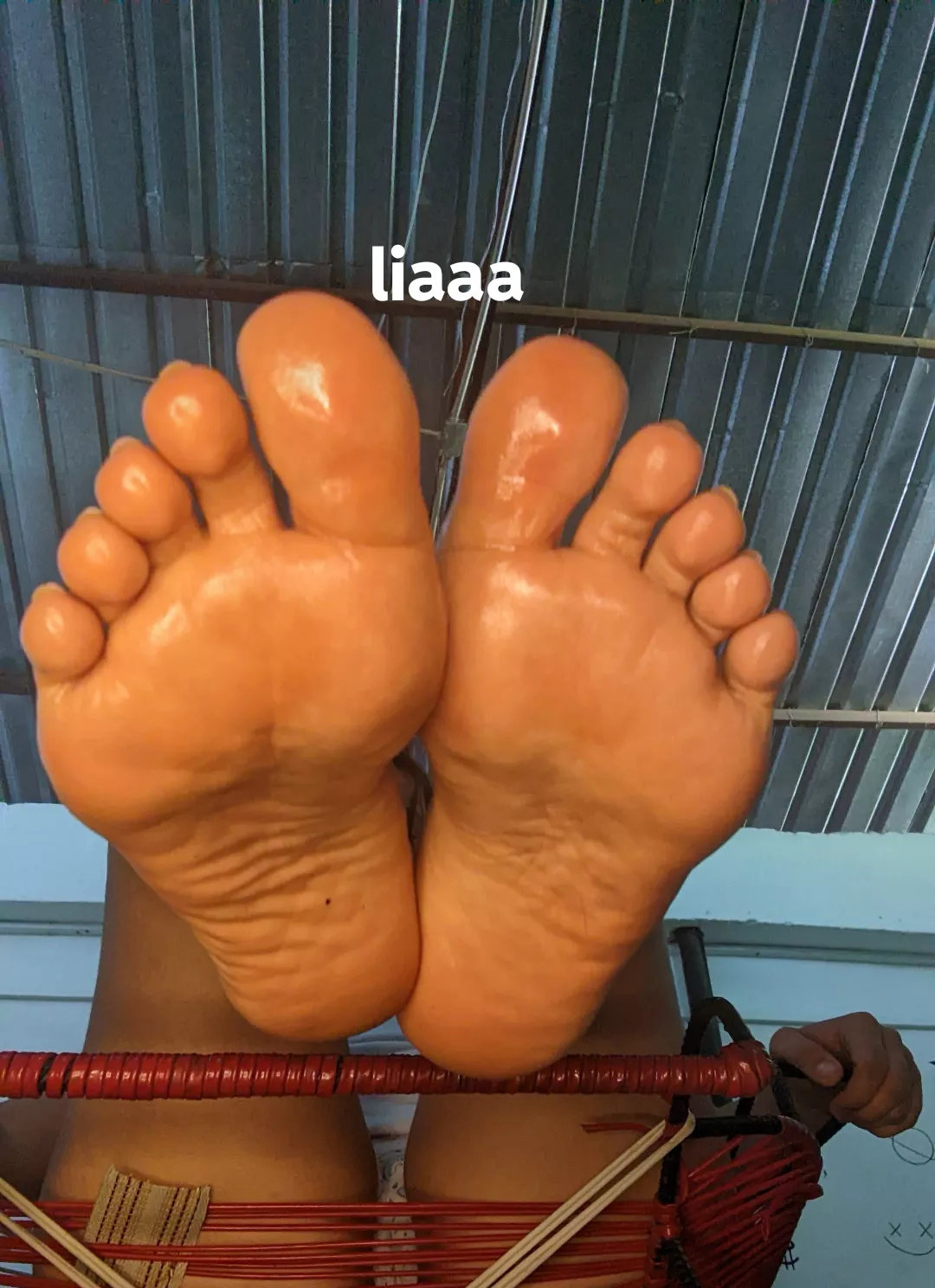 Oily soles 