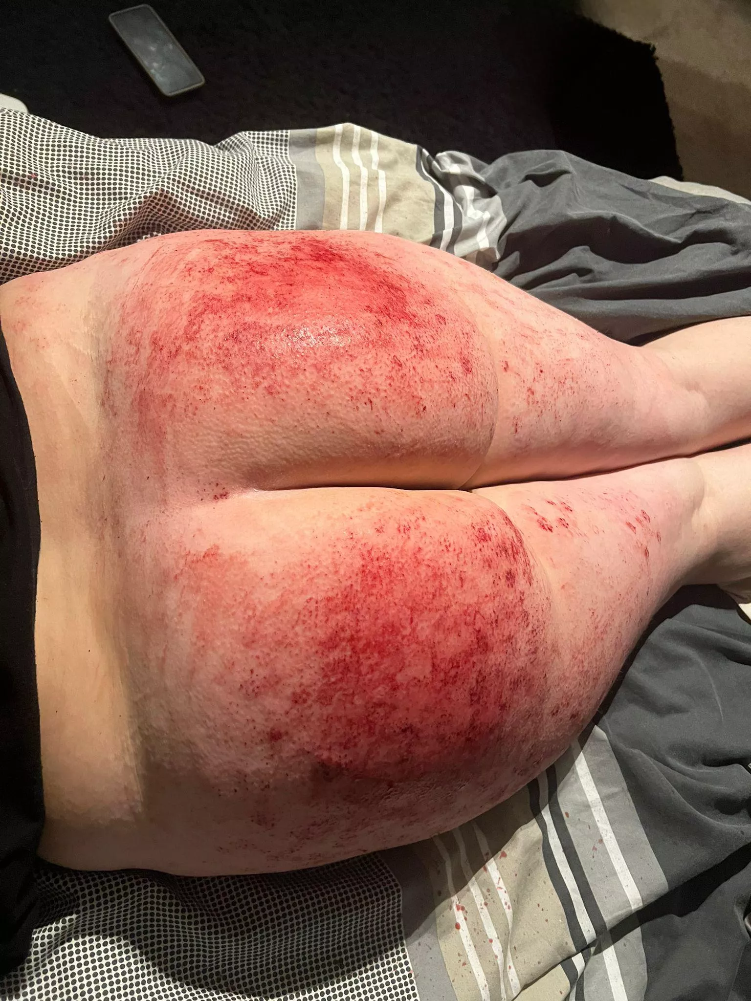 Paddled my friends ass today, love that I was covered in blood after this fuck 