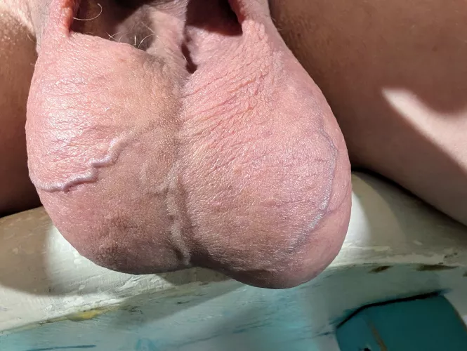 How do you feel about veins?