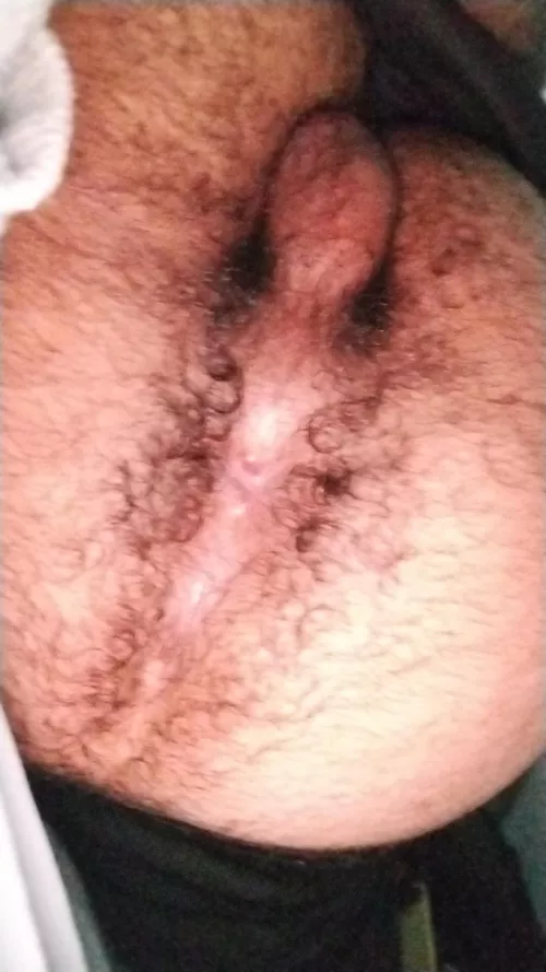 [18] it's hairy enough?