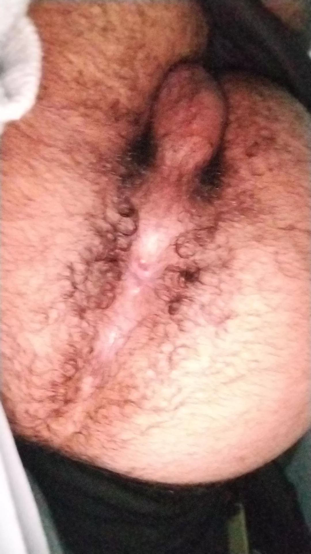 [18] it's hairy enough?