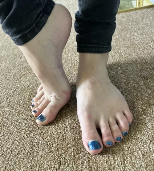 Blue toes and arches in your face