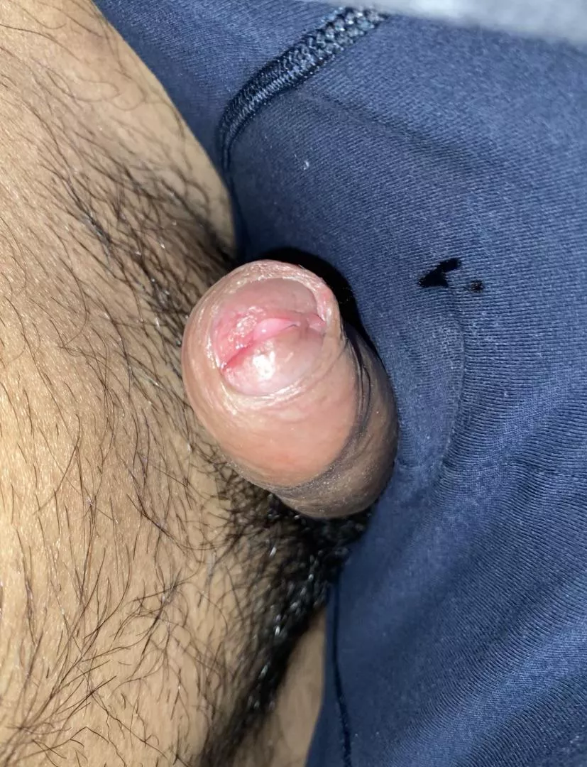 Once again sorry for being leaky 😅 (20)