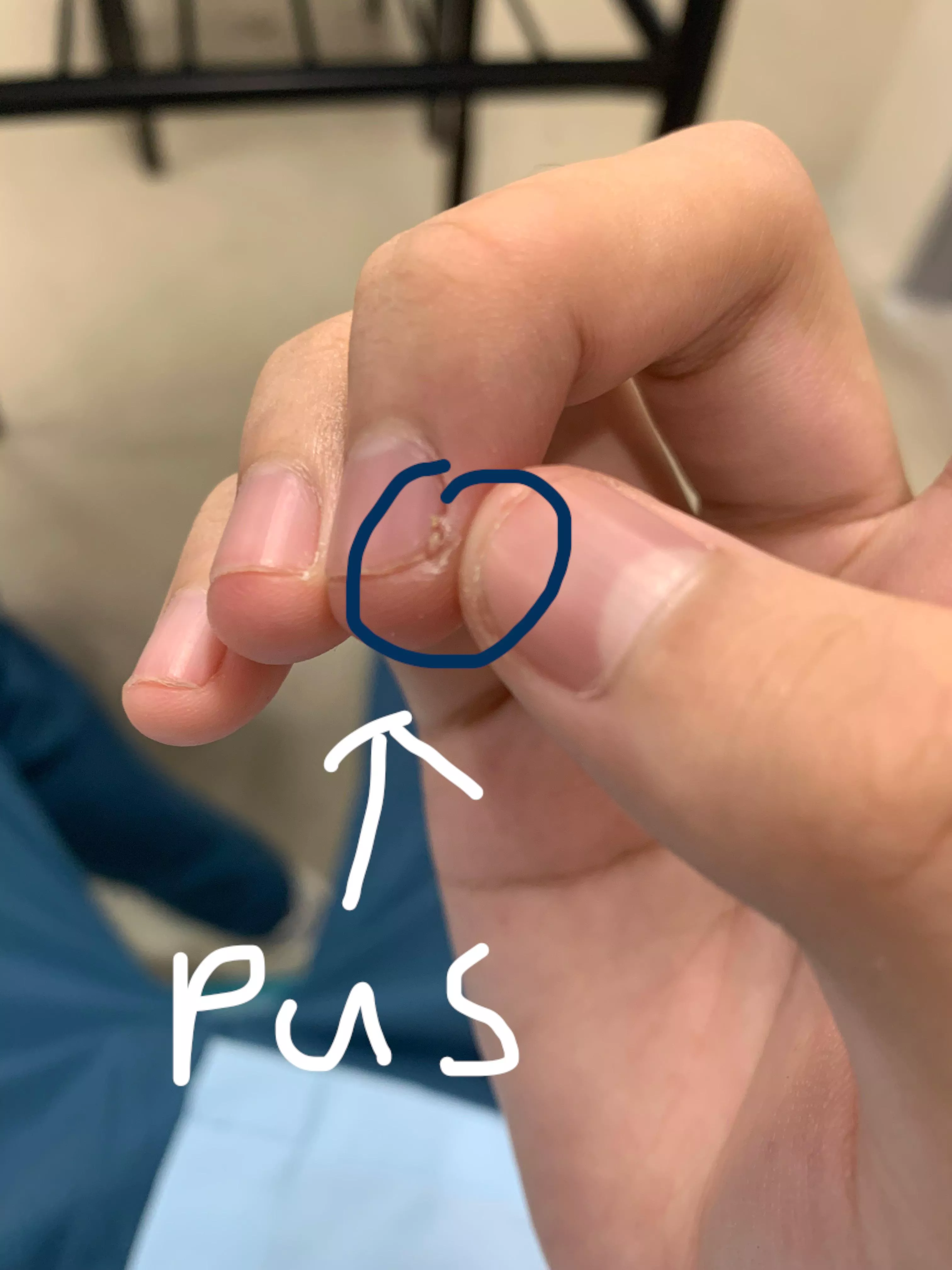 Long time lurker but finally got an opportunity to post in here when I popped this little bugger here.