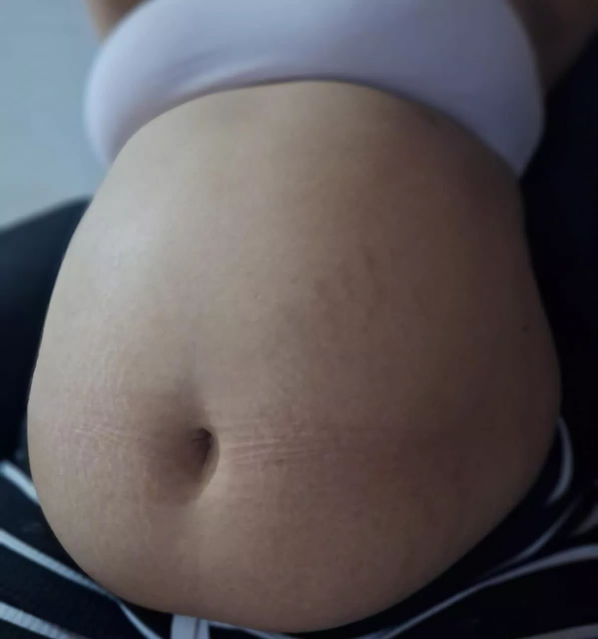 What do you like more, my belly or my stretch marks?