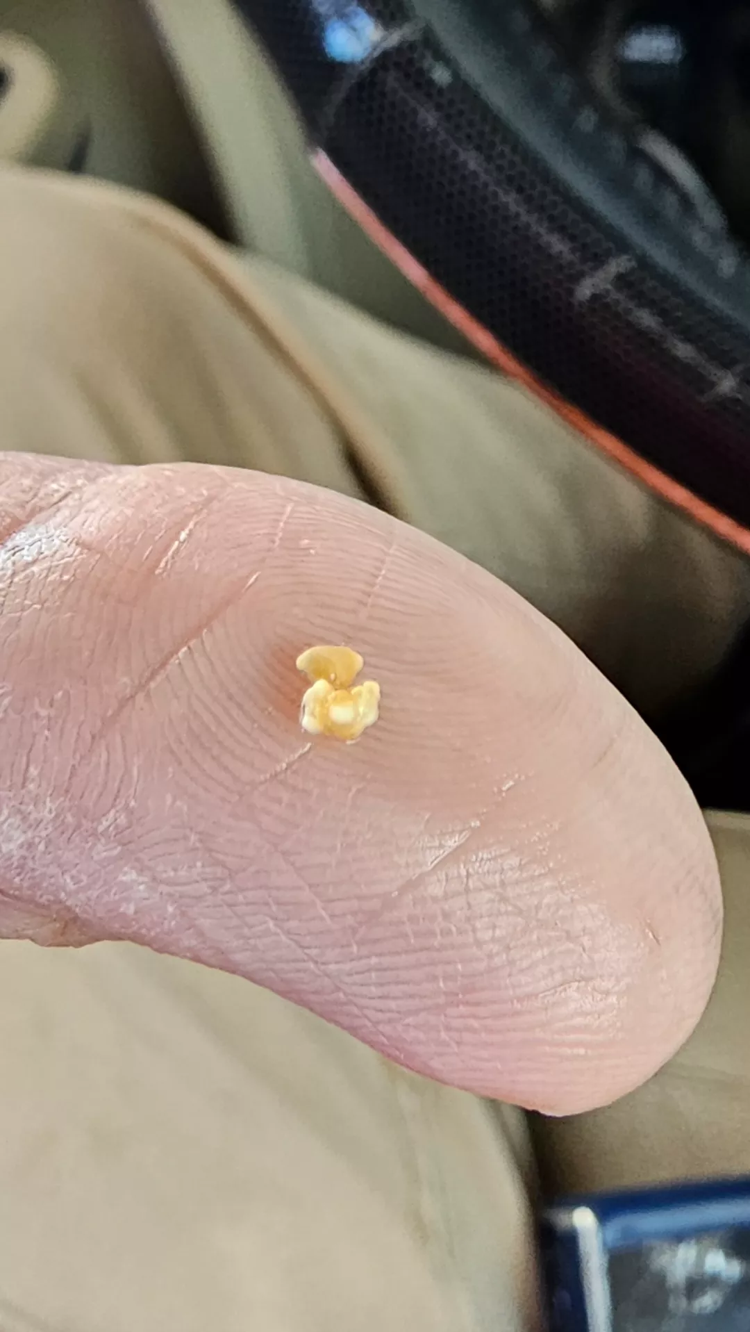 Just popped this out of a salivary gland under my tongue.