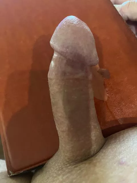 [57] It is what it is 