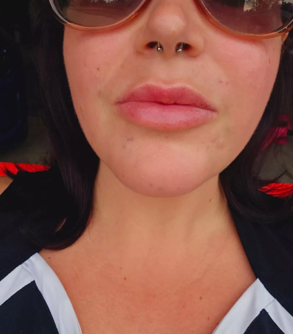 Freshly injected today!