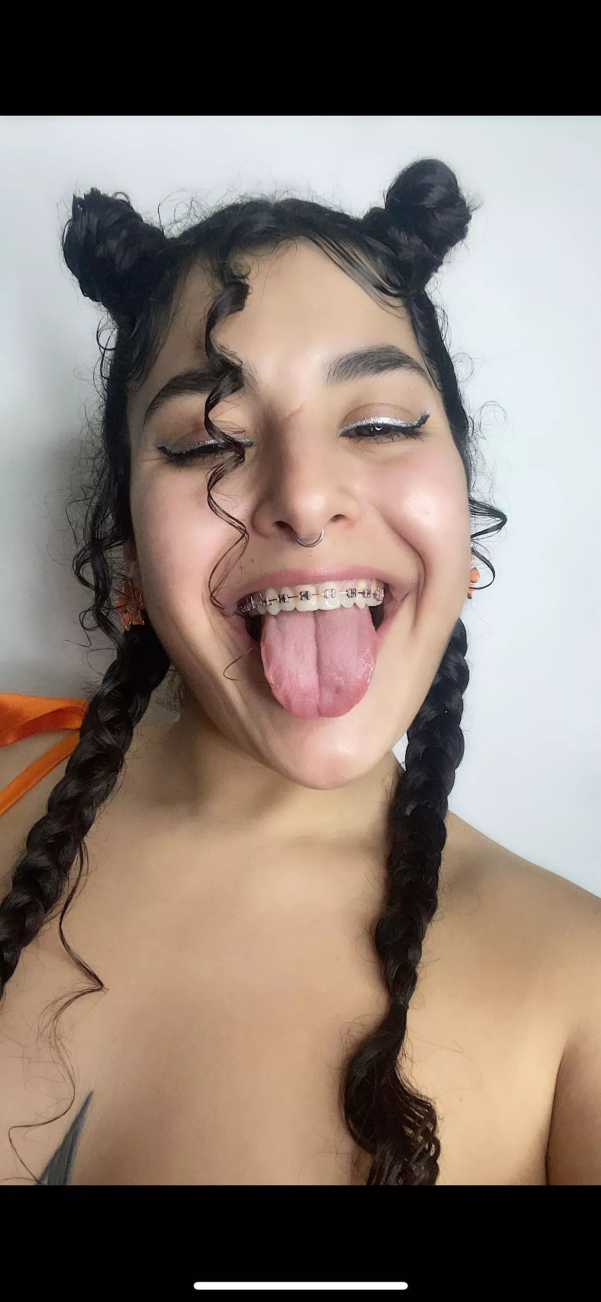 Fun with my look and my braces