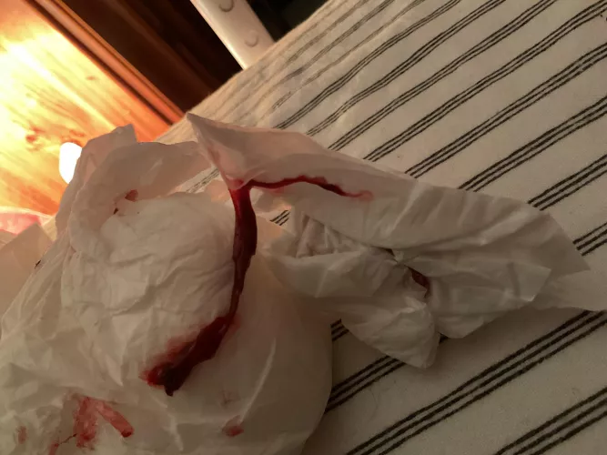 Just pulled this out of my nose