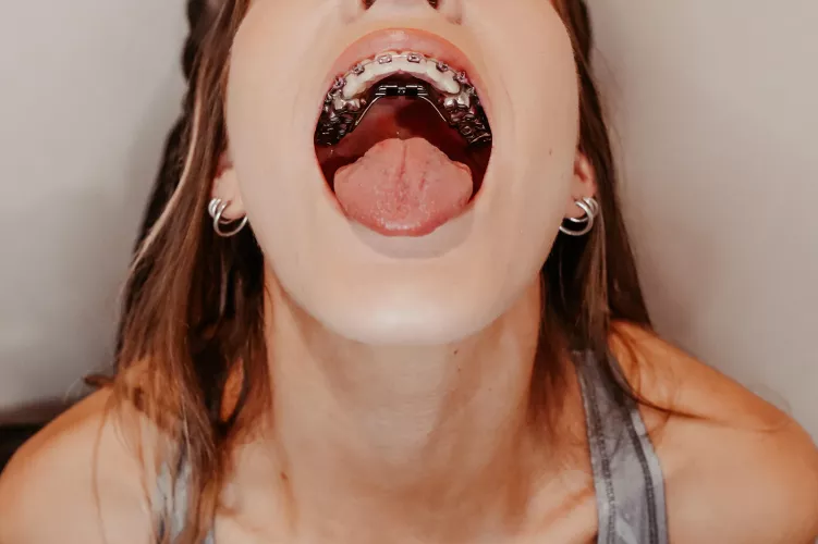 Open wide for the orthodontist, there’s a good girl