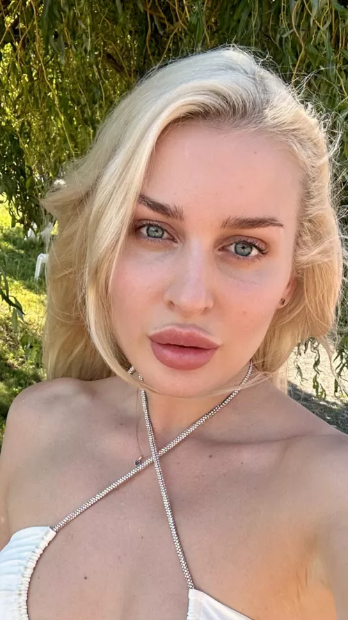 Are the lips overfilled or just perfect