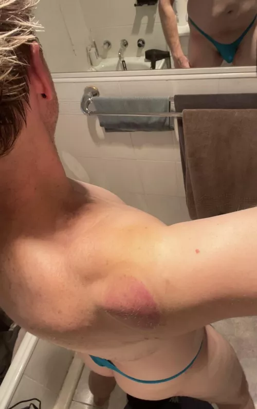 What do you think of thongs?