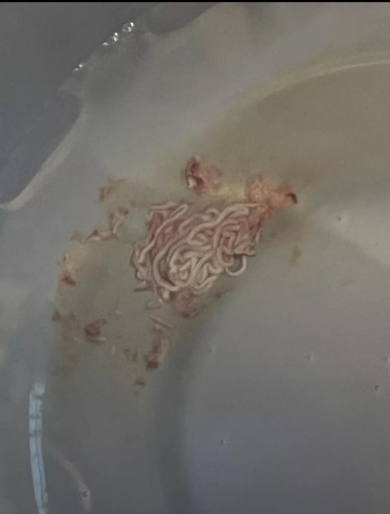 What squirted out on its own from sitting a sitz bath (Pilonidal)