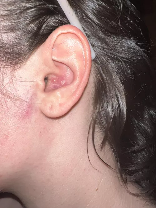 This is so painful.... Kms 