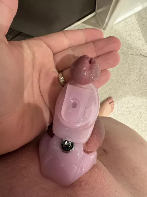 UPDATE: I ended up in surgery to get this off.