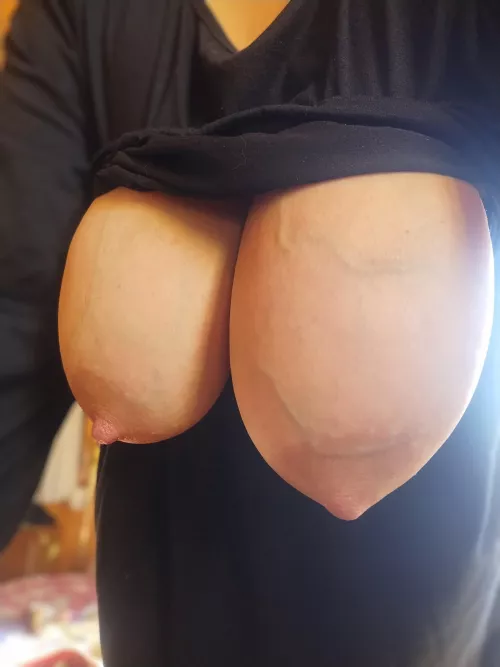 Guess which one needs relief