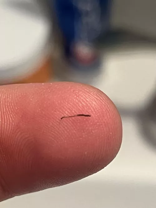 Just pulled this weird hair out of my beard 