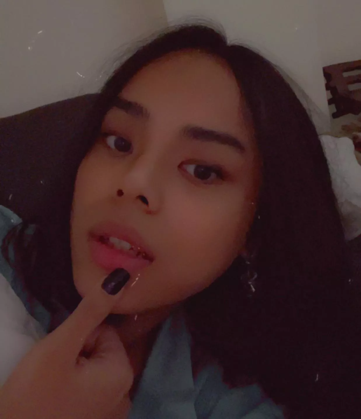 Hrt working its magic😭