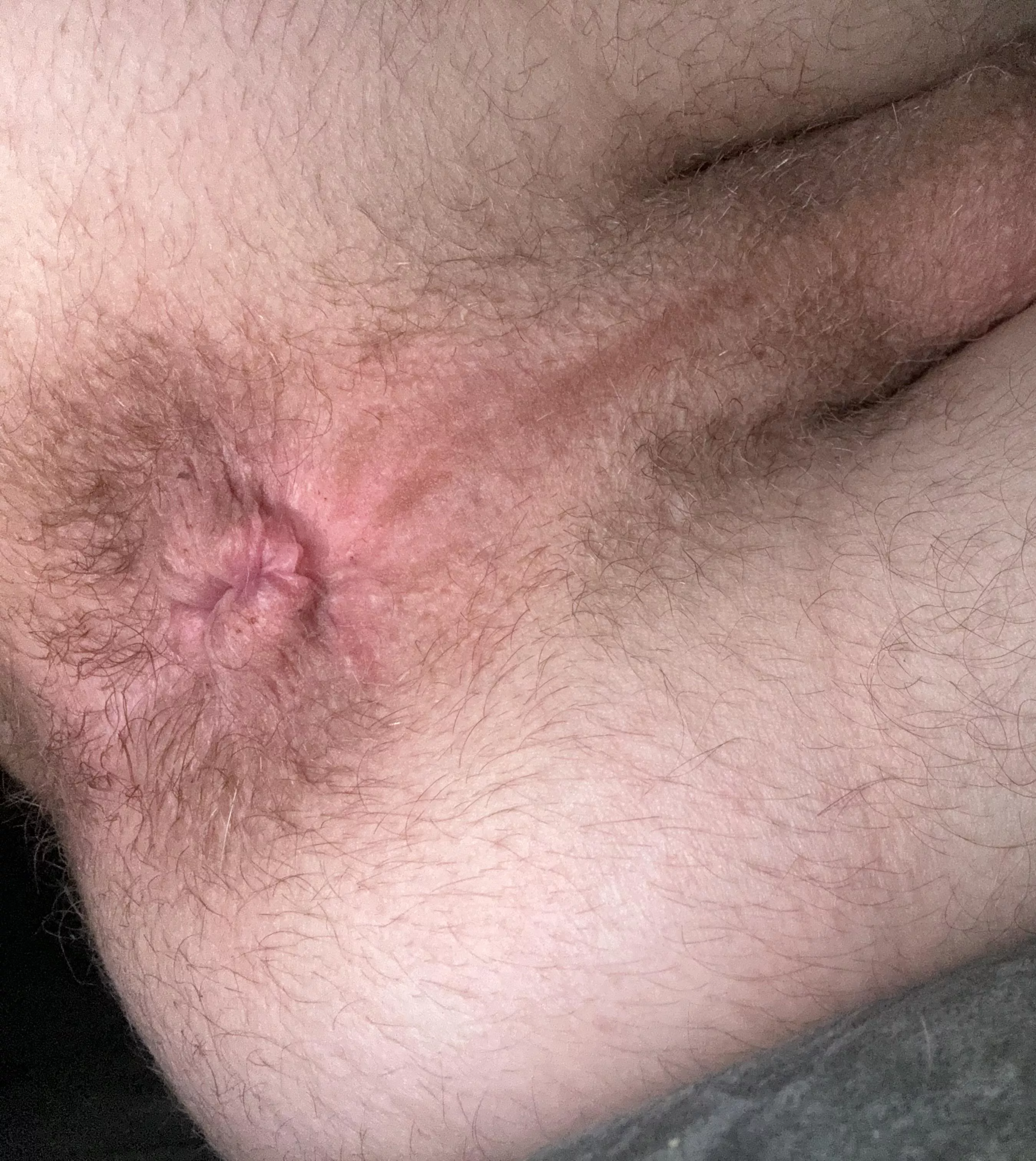 Hairy enough?