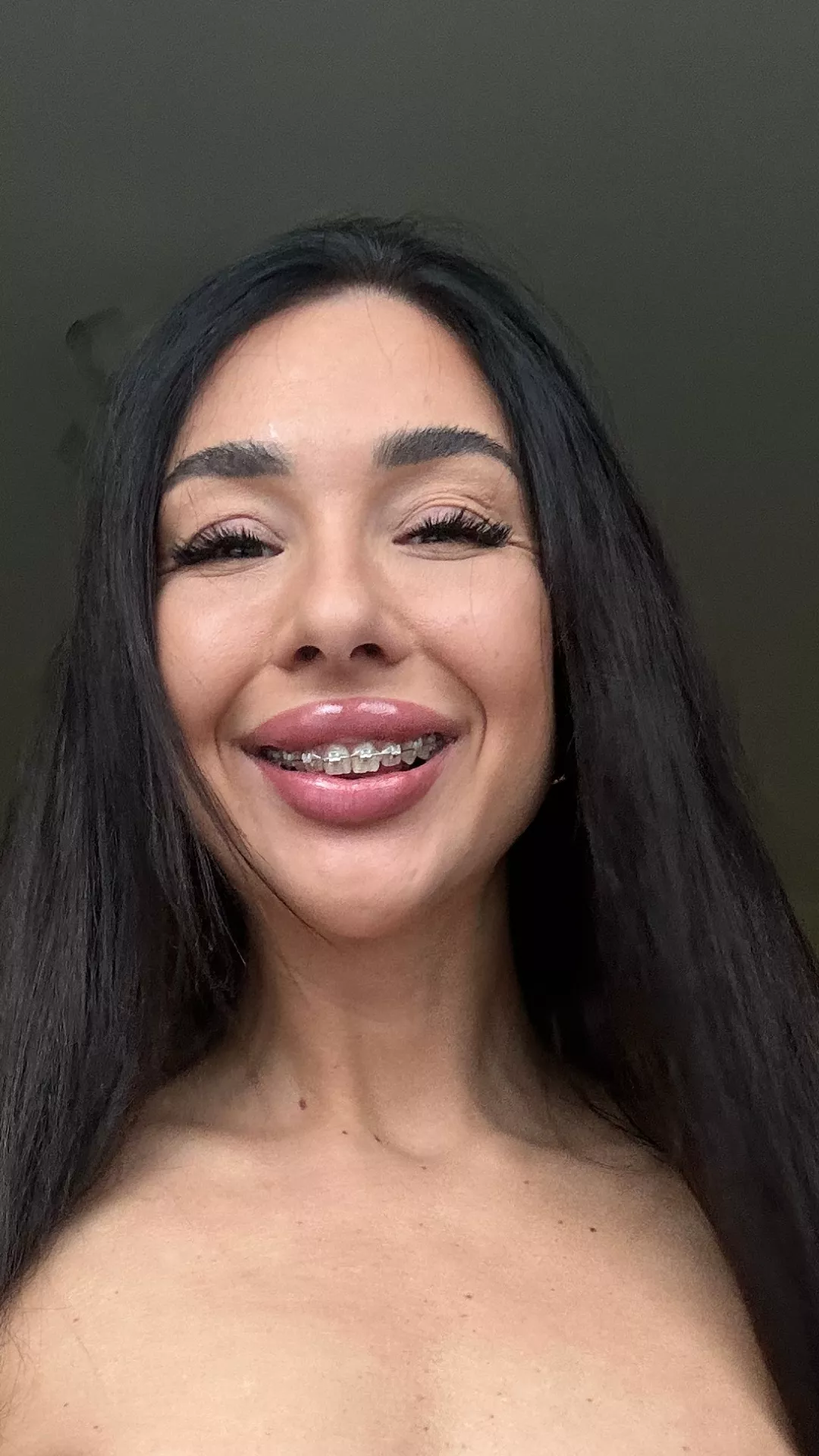 I'll do my best not to hurt you with my braces