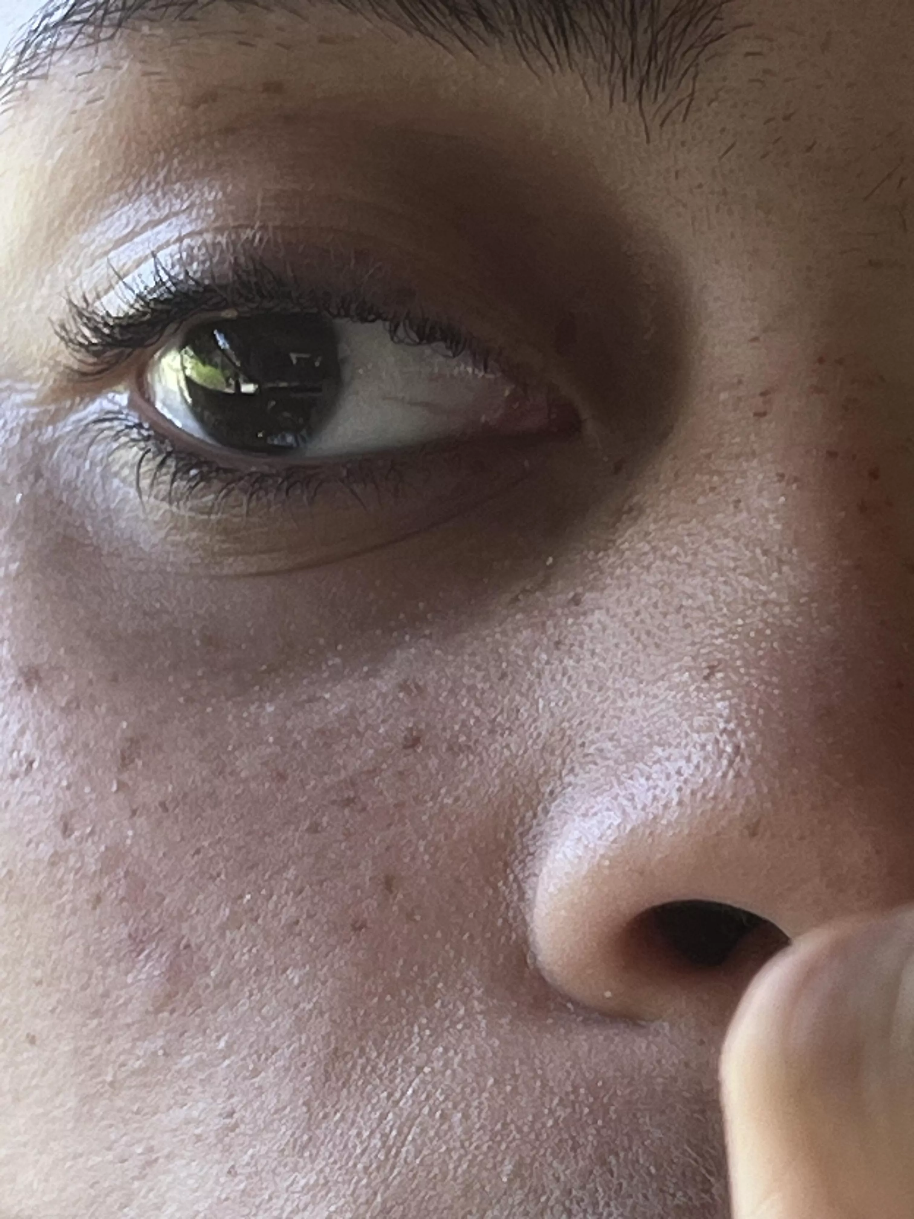 Forbidden pop in eye